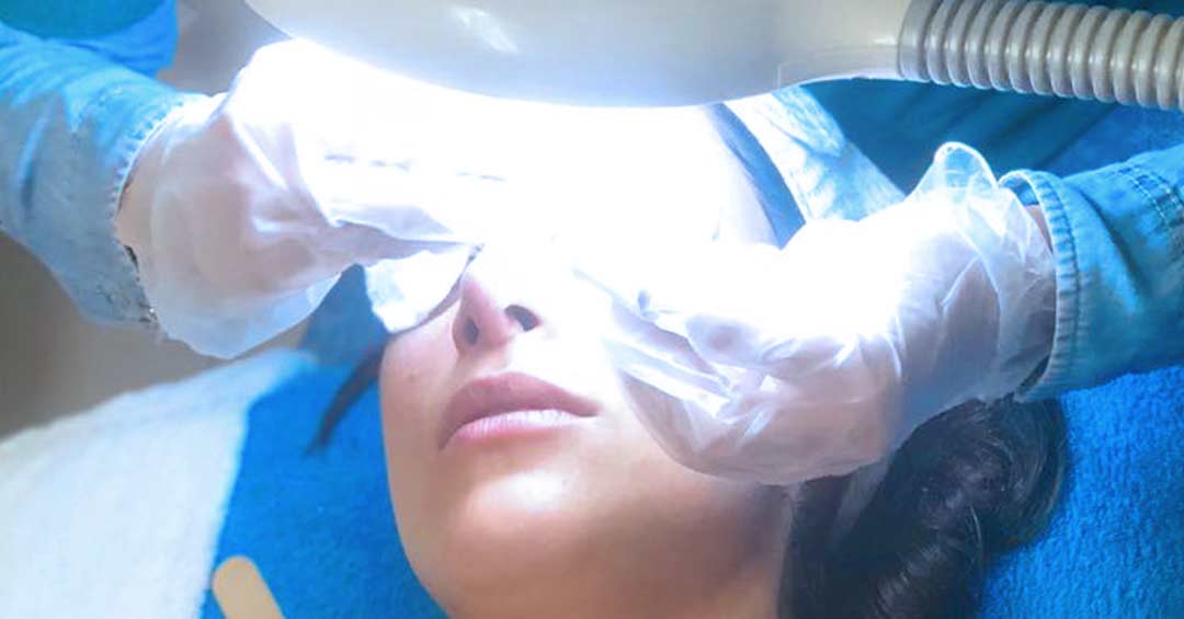 Limpieza Facial en Guadalajara